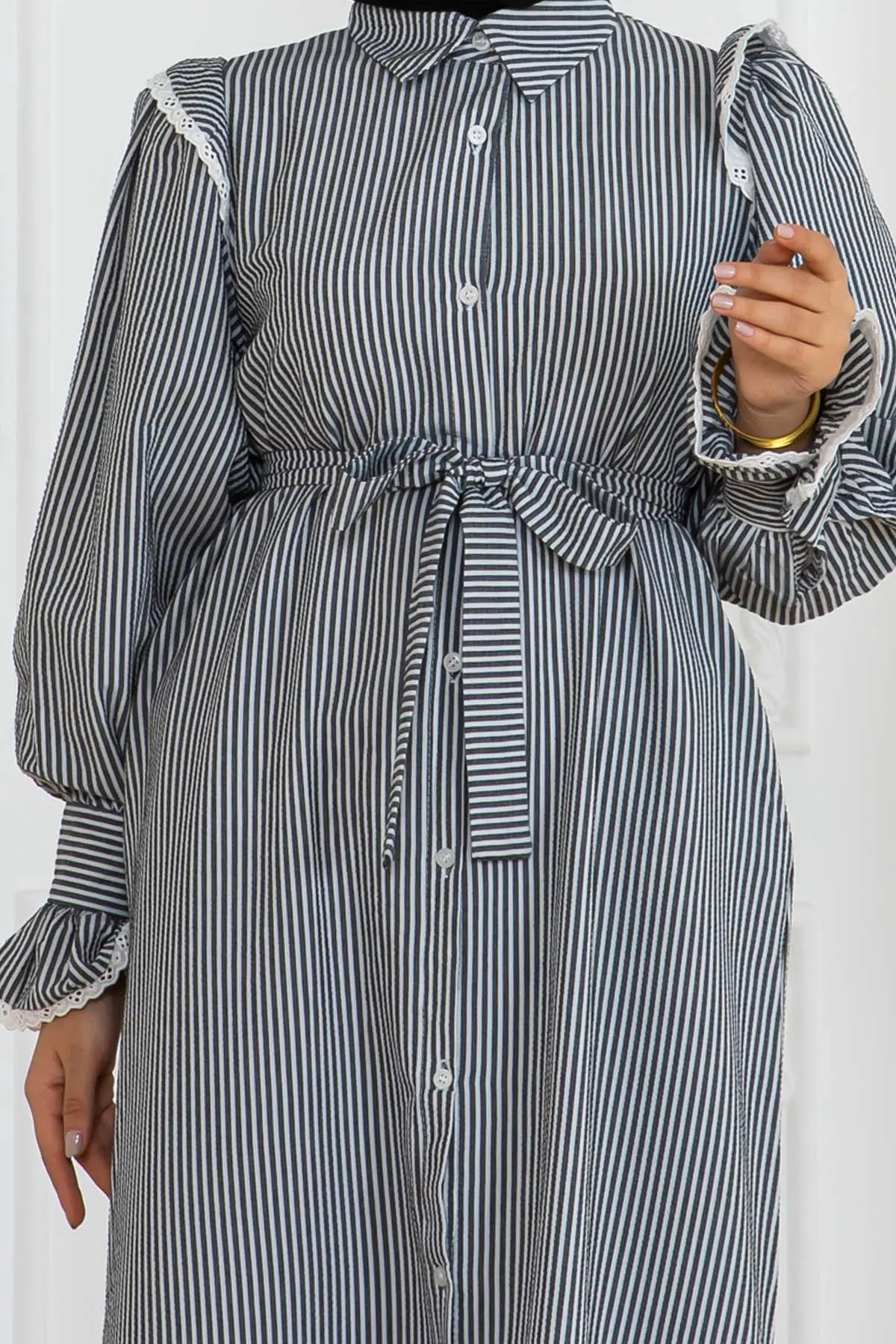 Striped Dress With Lace Detail-detail